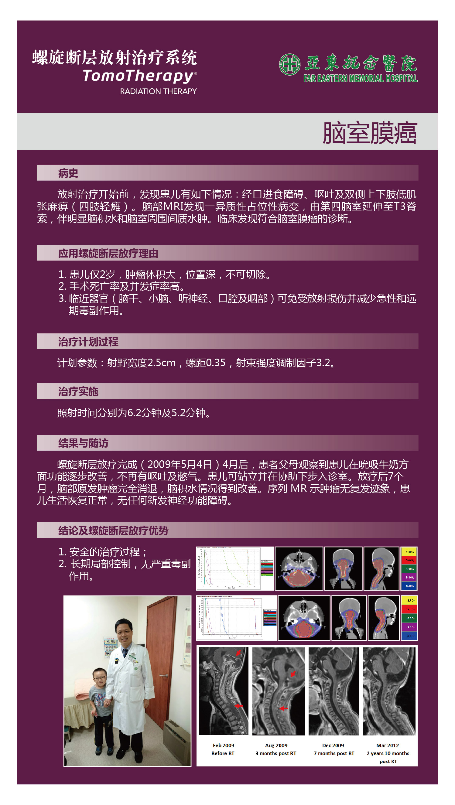 台湾亚东纪念医院-脑室膜瘤.jpg
